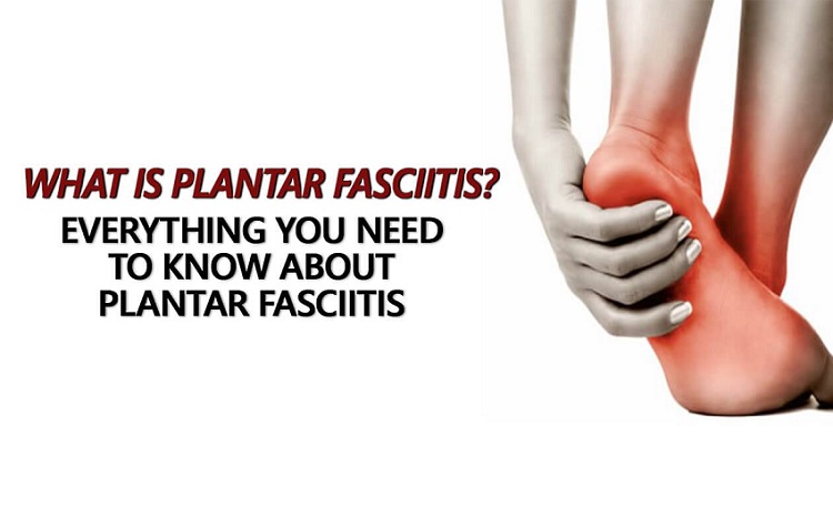 All You Need To Know About Plantar Fasciitis RRMCH